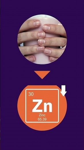 What Do White Spots on Your Nails Mean?