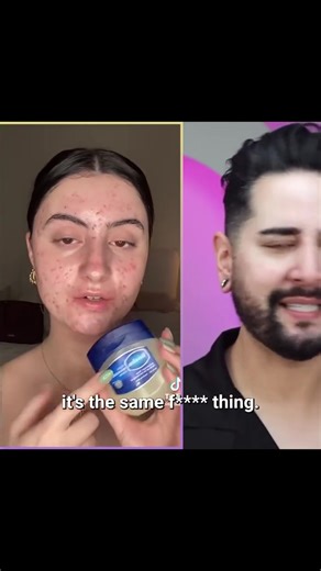 89K views · 924 reactions | The Slugging Trend Has Gone Too Far | James Welsh | Facebook