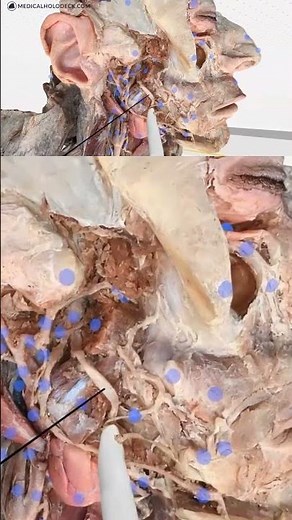 Study Human Anatomy: The Lingual Nerve