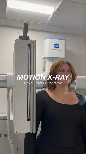 INTRODUCING: Motion X-ray Ever wonder what's really happening inside your joints when you move?🏃💨 Motion X-ray captures real-time movement, revealing hidden injuries, joint instability, and misalignments that static images can't catch! Got questions? Call or stop by today 📞 | Chiro Effect Chiropractic LLC
