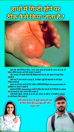 हाथों में गिल्टी होने पर ठीक कैसे किया जाता है ? Cyst removal techniques || #viral #cysts