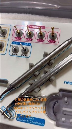 副鼻腔底の骨が薄い症例で行うソケットリフト用SCAキット。安全に骨造成し、インプラントを支えるための器具です。#ソケットリフト #SCAキット #広島市 インプラント#shorts