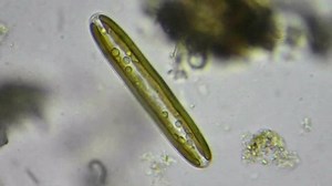 clip-4380548-live-diatom-alga-under-microscope-magnification-1600x
