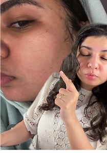 نتيجة ٦ شهور من استخدام كريم TOSOWOONG