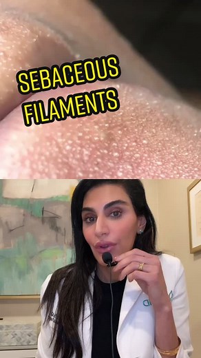 #duet with @sknqueeen sebaceous filament💫 Satisfaction guaranteed #sebaceousfilament #extractions #skincarehacks #skinbydrazi