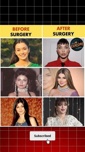 “Plastic Surgery Transformation 😱 Before vs After!”#foryou