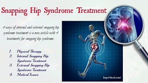 Snapping Hip Syndrome: oorzaken, symptomen en behandelingen - A-To-Z-Gidsen 2025