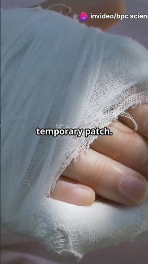 How broken bones heal in the human body #science #biology