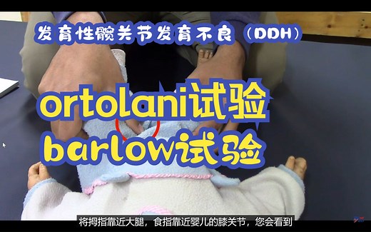 发育性髋关节发育不良（DDH）-ortolani试验和barlow试验