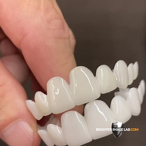 3.1K views · 47 reactions | Here's a color comparison between our Translucent (top) and our Ultra White (bottom) Learn more at Brighterimagelab.com | Press On Veneers by Brighter Image Lab | Facebook