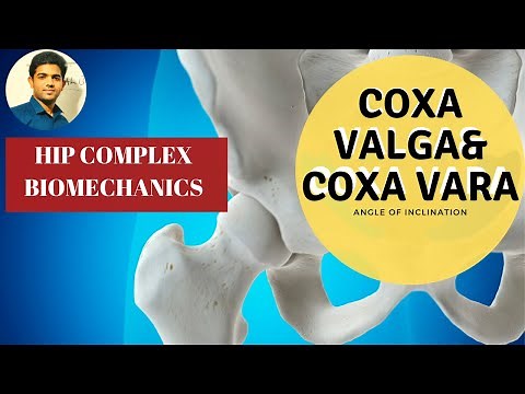 Angle of Inclination |Coxa Valga | Coxa Vara- (Hip Biomechanics)