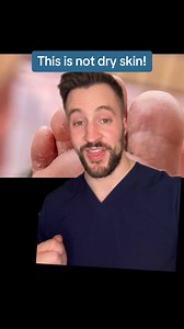 Not dry feet! | Dermarkologist