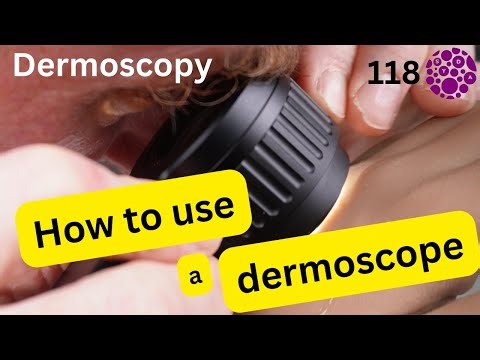 How to use a Hybrid Dermoscope and 10 top reasons people fail