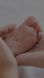 🚨 Warning: Measles cases are surging across North America this holiday season. Educators, protect your students and staff with a scientifically-proven solution! Our UVC air purification systems reduce airborne viruses by damaging viral DNA, rendering them harmless. By inactivating infectious particles, we lower the risk of transmission - especially crucial in classrooms where children share the same air for extended periods. Give yourself peace of mind knowing you're taking proactive steps to s