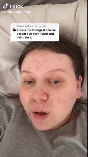 Decoding The Scouse Accent: A Look Into Liverpool's Unique Dialect