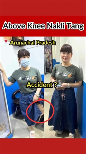 Above Knee Nakli Tang #prostheticlimb #bornlife #artificialleg #artificiallimb #foryou #prosthesis