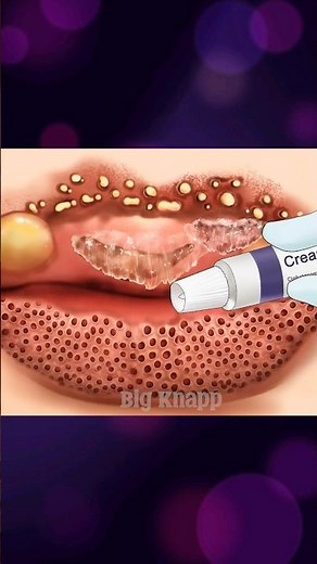 ASMR Damaged Lips Cleaning 💋✨ | Lip Skin Repair#animation