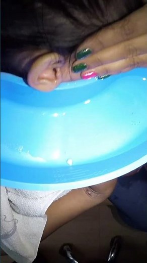 Removing STUCK Styrofoam in Girl's Ear