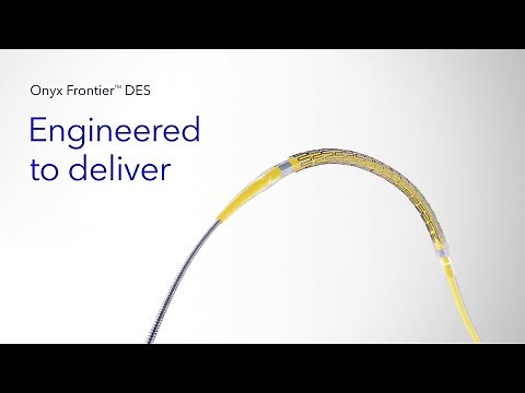 Onyx Frontier DES - Engineered to Deliver