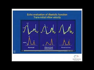 Episode 5: Diastolic LV function