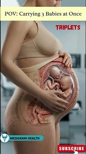 35 Weeks Pregnant with Triplet | See how Triplets Fit Inside in the womb