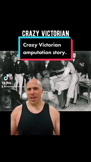 Crazy Victorian Amputation Story Uncovered
