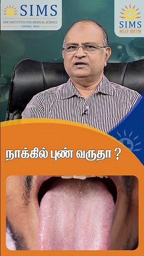 Do You Have a Mouth Ulcer on Your Tongue? Causes, Care & When to See a Doctor