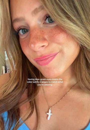 Discovering Central Heterochromia in Blue-Green Eyes