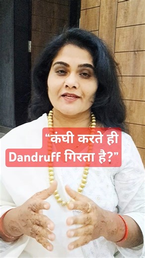 “कंघी = Dandruff snowfall? जानिए असली वजह”#youtubeshorts #haircare