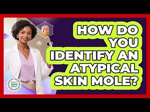 How Do You Identify an Atypical Skin Mole?