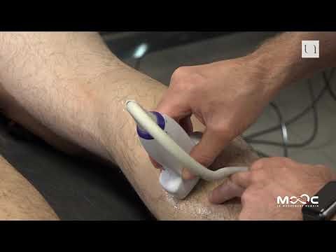 Le Mouvement Humain : L'électromyographie