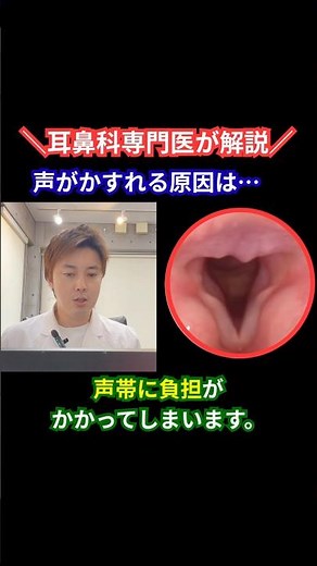 声がかすれる原因は声帯？正常な声帯と病気の違いを解説｜名古屋市港区・中川区の耳鼻科医 #声帯 #声枯れ #shorts