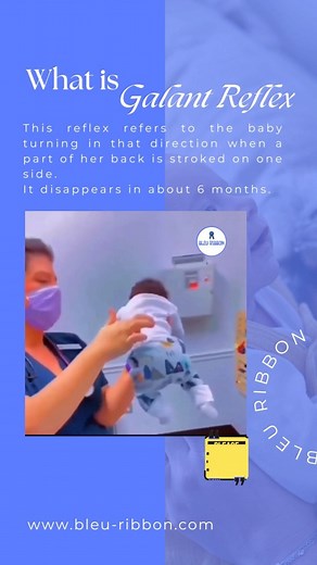 1.2K views | Do you know what Galant Reflex? This reflex refers to the baby turning in that direction when a part of baby’s back is stroked on one side. If it lasts longer than 1 year, it may cause problems in toilet training and prevent children from sitting in a chair for a long time. #babyswing #highchair #babyproducts #galantreflex #baby #babyhealth | BleuRibbon Baby Essentials | Facebook