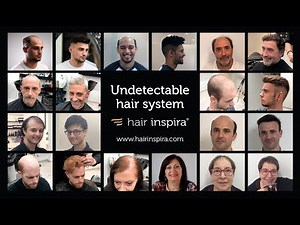 Prótesis capilar indetectable (RECOPILACIÓN) – Hair Inspira