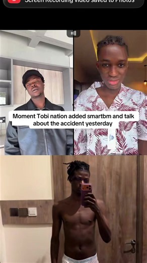 #tobination #smartbm #accident | tobi bicycle kick