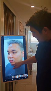 633K views · 7.3K reactions | Grand reveal rhinoplasty and Chin Augmentation | Clara V Clinic | Facebook