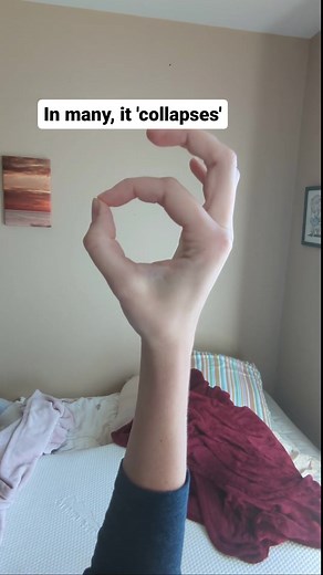 Thumb Injury Recovery Tips: How to Treat Hyperextended Thumb