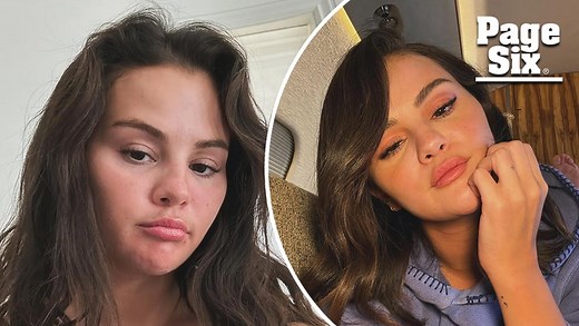 Selena Gomez reveals which cosmetic procedure she’s had done after fan speculation