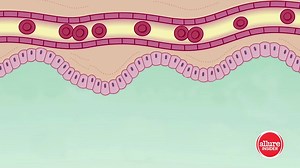 22K views · 76 reactions | Thinking about lip injections? Here's what you need to know. | Allure | Facebook