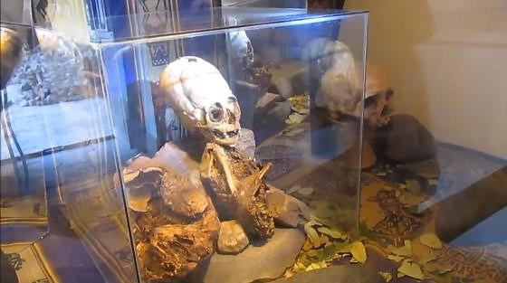 Anatomy Expert's Opinion Of Human Hybrid Skeleton In Peru