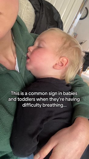 Understanding Head Bobbing in Babies: A Sign of Distress