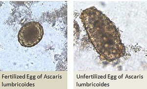 Direct Saline and Iodine Wet Mount • Microbe Online