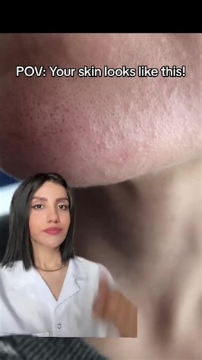 Clear up your skin with the Personal Microderm!