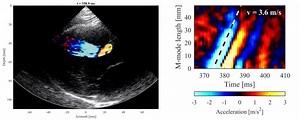 31K views · 17 reactions | #JACCIMG Editors’ Insights: Can passive myocardial stiffness be non-invasively assessed in humans? Cardiac natural shear wave imaging may become a powerful tool for assessing myocardial properties. Learn more: https://bit.ly/2PxppRr | JACC Journals | Facebook