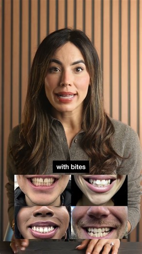 The Secret Behind Smile Direct Club’s Collapse