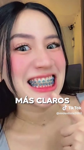 Colores de Brackets que NO Debes Usar