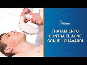 Tratamiento Contra el Acné con Luz Pulsada Intensa (IPL) - Clínica Chávarri