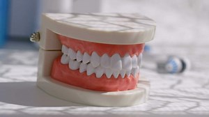 a model of a tooth with a toothbrush