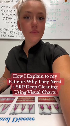 It is so important to educate and explain to our patients why we are doing what we are doing! So often patients do not feel like they understand what is going on. Visual charts have helped me so much when explaining PERIO and why a patient needs SRP Deep Cleaning! ✨🪥🦷 #rdh #dentalhygienist #dentalhygiene #dentalfitness #dentalhygieneschool #dentalprophylaxis #deepcleaning #srpcleaning #srp #periodontaldisease #perio #gingivitis #rdhlife #dentalhygienestudent #dentalhygienistlife #visualchart #