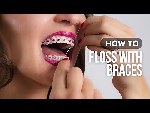 How to Floss with Braces